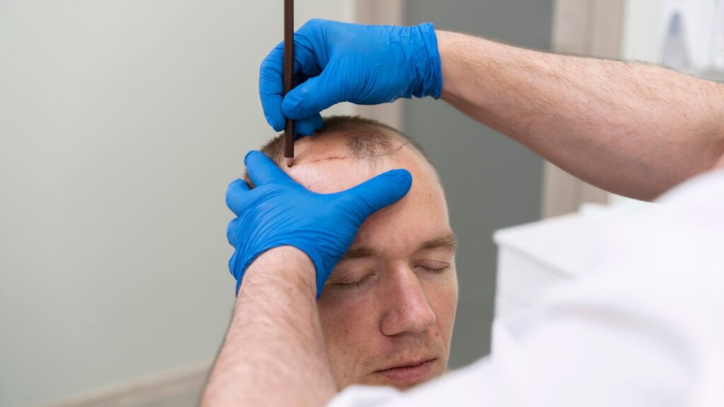 Hair Tattoo Cost Vs Hair Transplant Cost