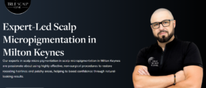 Hairline Restoration in Milton Keynes