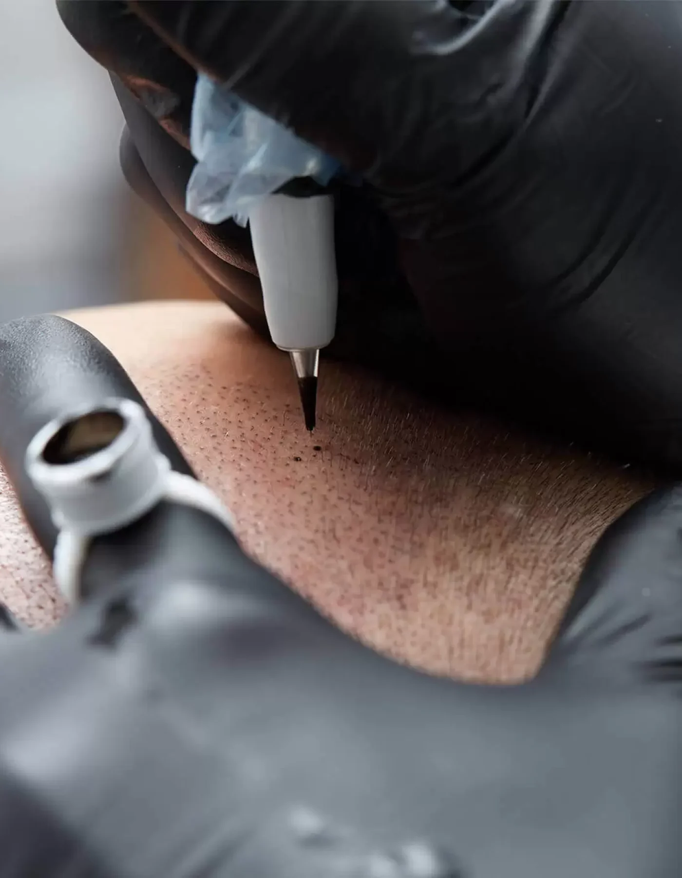 scalp-mirco-pigmentation-glove